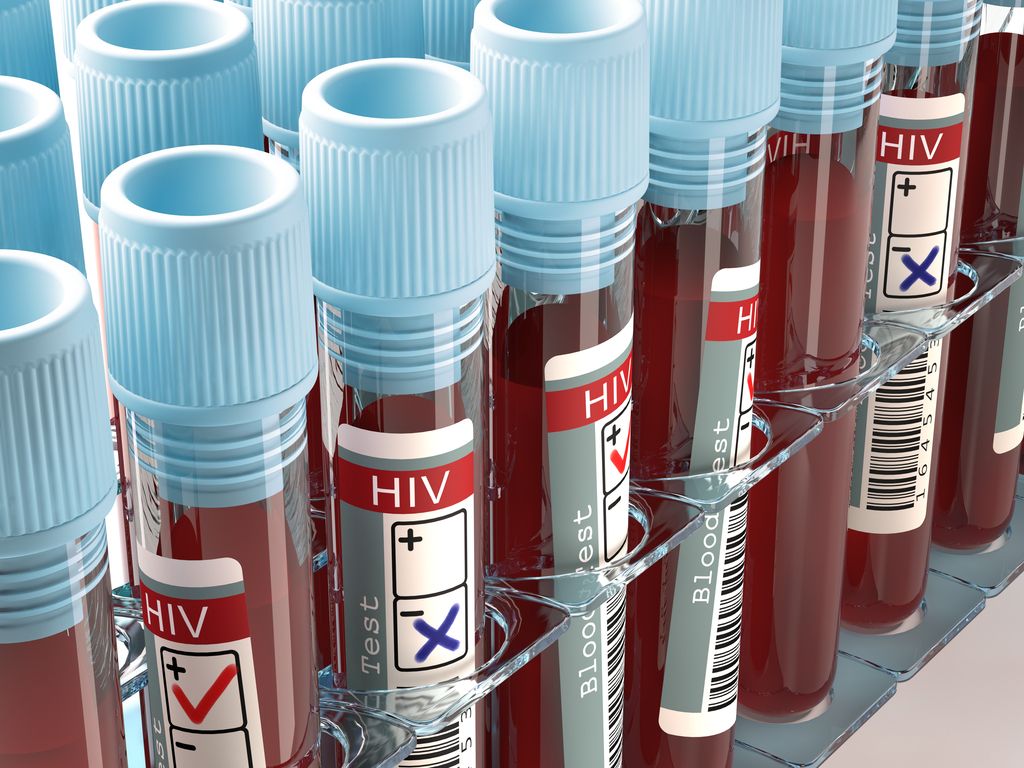 Testes de HIV - descobertas científicas