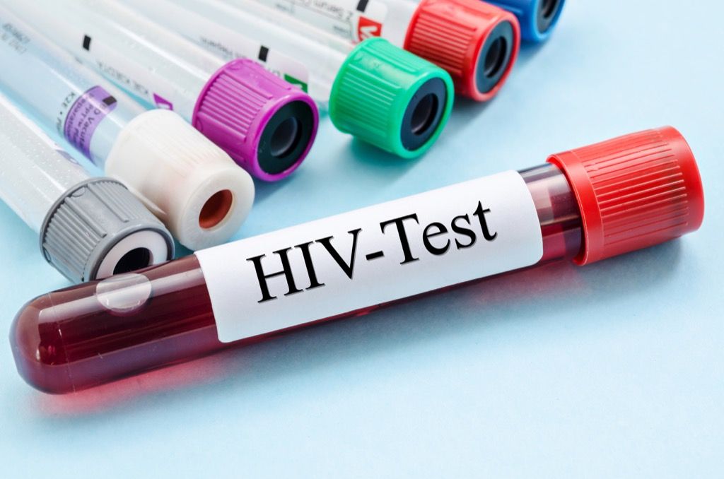 فحص الدم لفيروس نقص المناعة البشرية