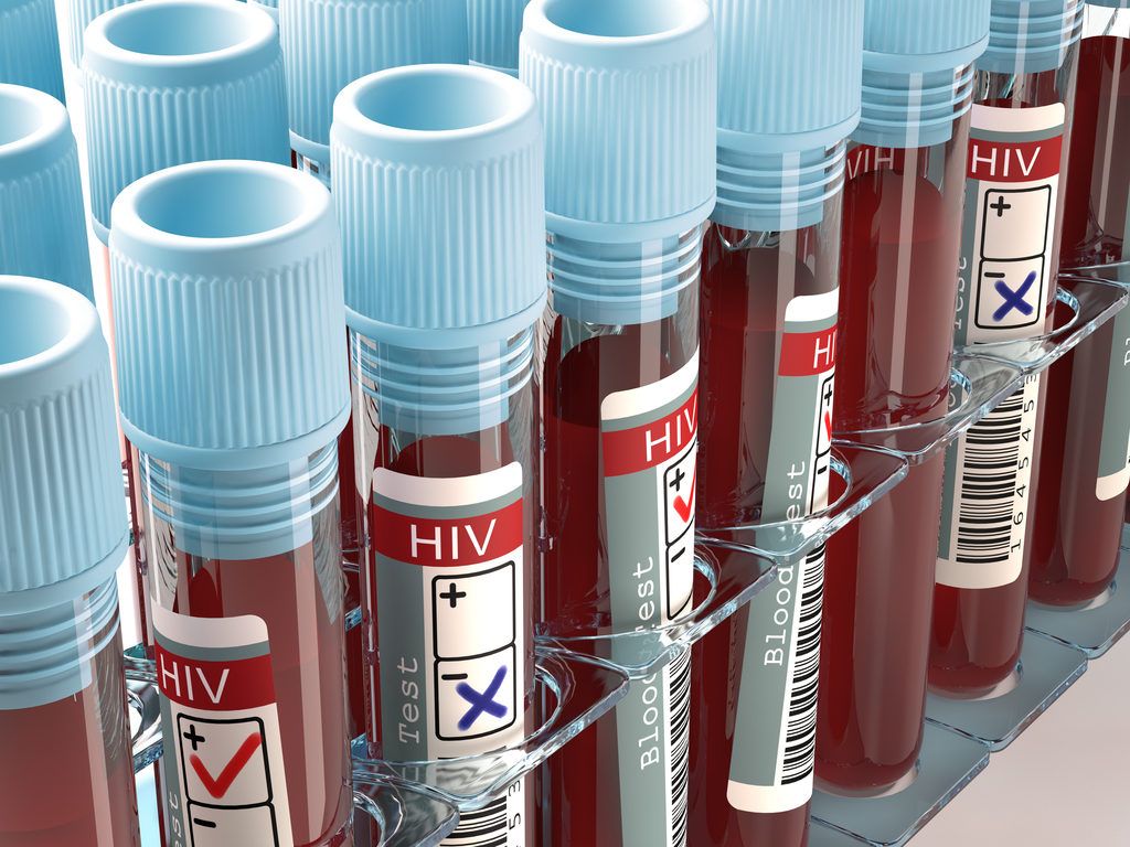 Scoperte scientifiche di test HIV