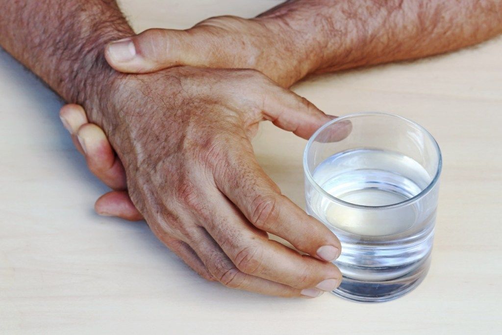 manos de la enfermedad de Parkinson