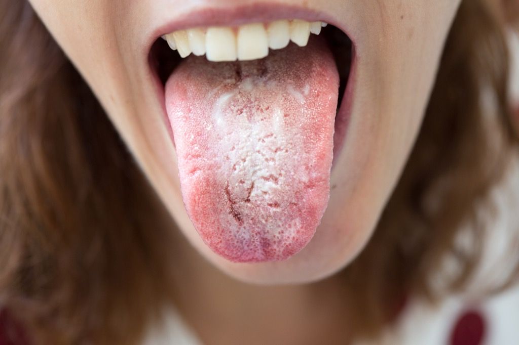 Ustni drozžni jezik