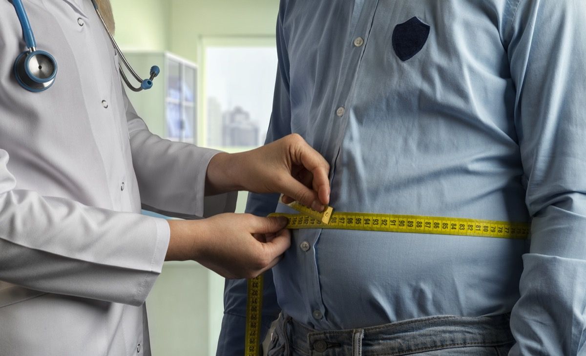 डॉक्टर अधिक वजन वाले व्यक्ति की कमर की माप करते हैं