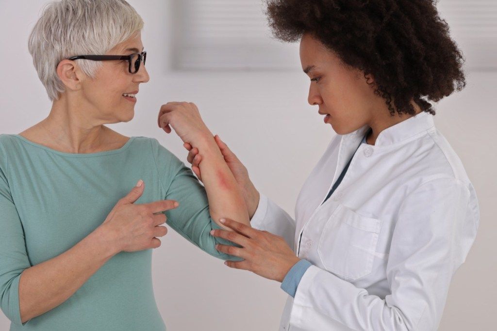 Pasien wanita menunjukkan ruam lengannya kepada dokter