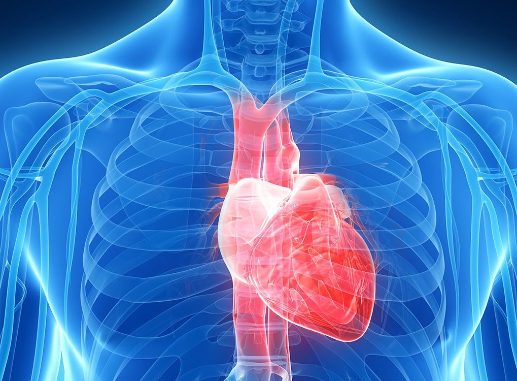 angioplastie pour la santé cardiaque, lignes de ramassage si mauvaises qu