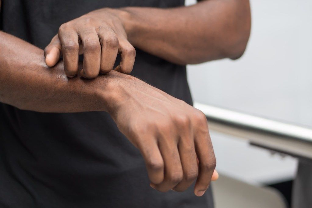 hombre negro pica el brazo, hechos de cáncer de piel