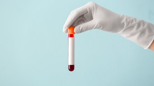   Лекар's hand holding test tube with blood sample on color background