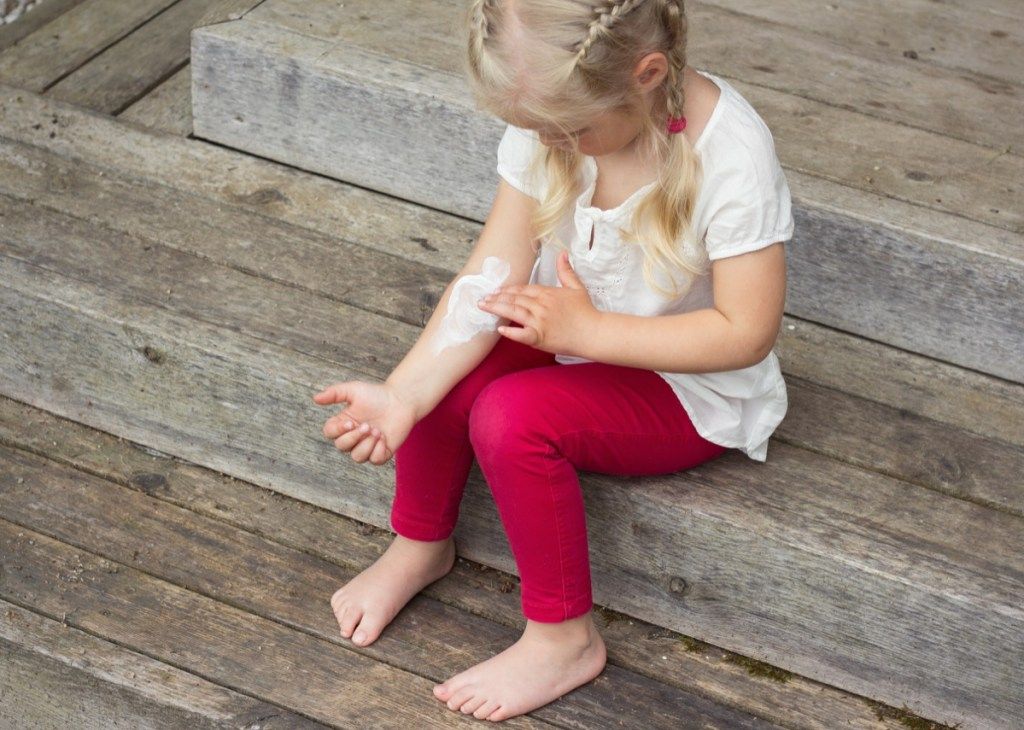 فتاة صغيرة تضع كريمًا على ذراعها بسبب الحساسية بسبب الأكزيما