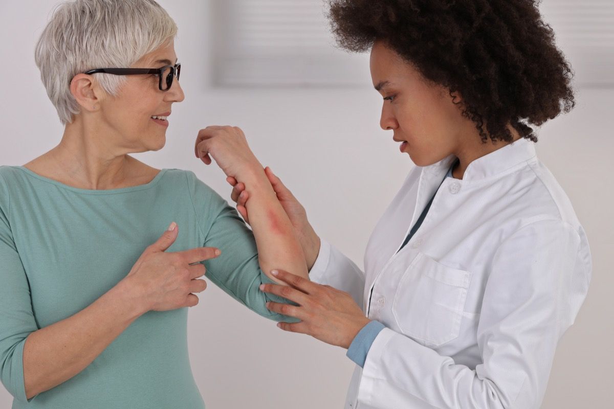 Paciente do sexo feminino mostrando a um médico a erupção cutânea no braço
