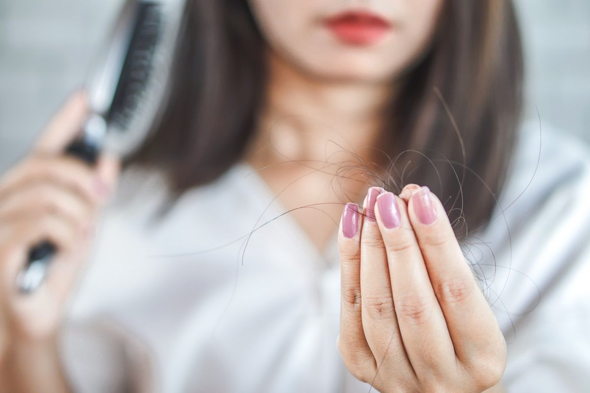 Moteris, turinti plaukų slinkimą