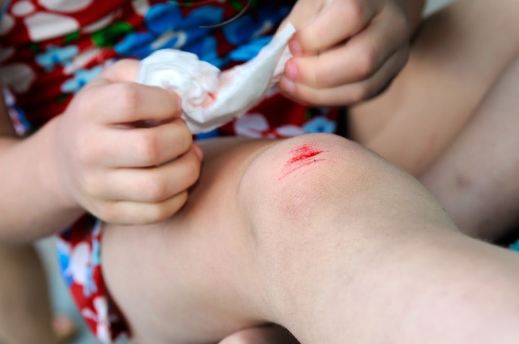 luka kecil di lutut
