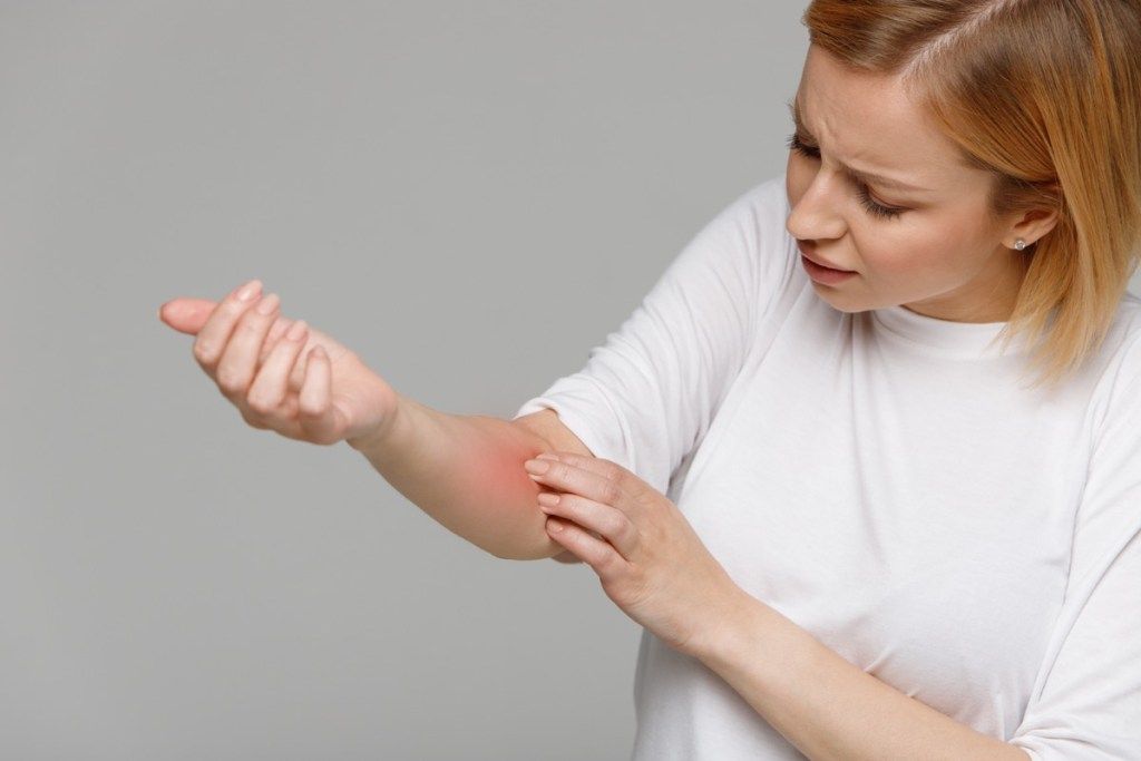 Kvinne som ser på den røde betente huden på armen