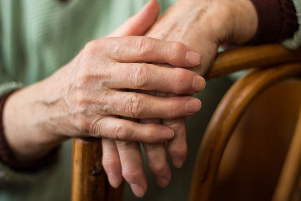 Mga kamay na may Rheumatoid Arthritis