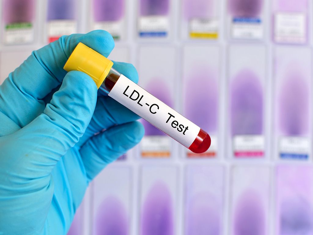 test LDL kolesterola