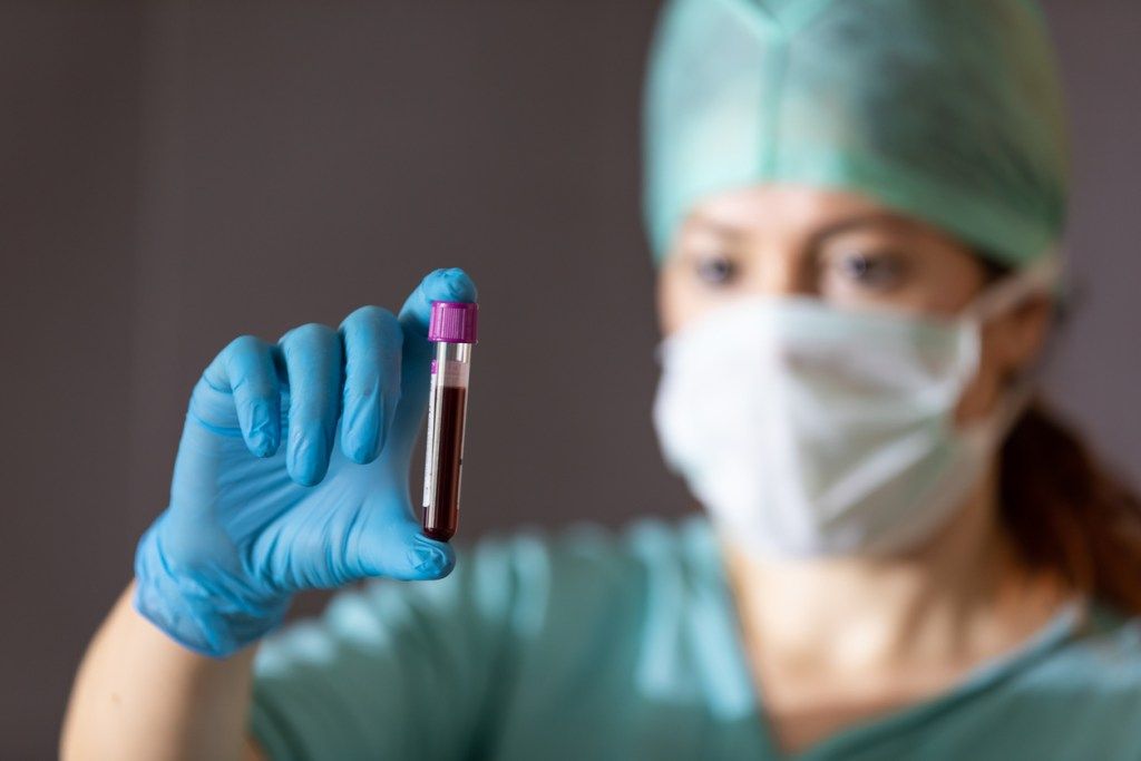 Nainen aasialainen lääkäri nostaa koepalaa verta