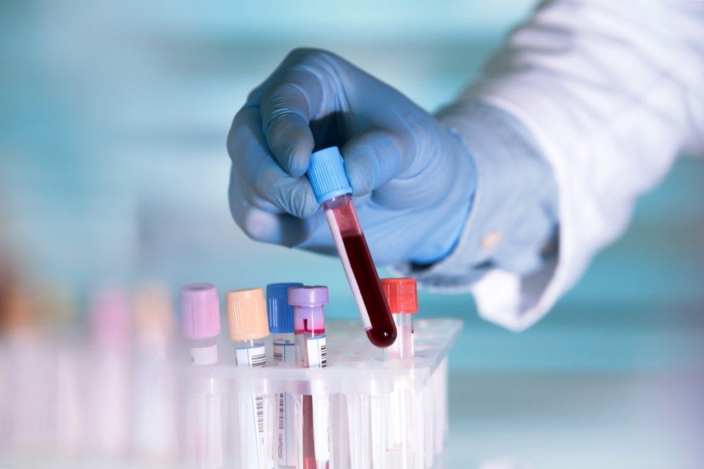 Nhà khoa học đeo găng tay cầm xét nghiệm máu