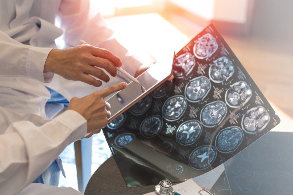 MRI ดิจิตอลเอ็กซเรย์สมองโดยมีทีมแพทย์รังสีวิทยามะเร็งวิทยาทำงานร่วมกันในโรงพยาบาลคลินิก แนวคิดการดูแลสุขภาพทางการแพทย์ (เอ็กซเรย์สมองแบบดิจิตอล MRI โดยมีทีมแพทย์รังสีวิทยามะเร็งวิทยาทำงานร่วมกันในโรงพยาบาลคลินิก