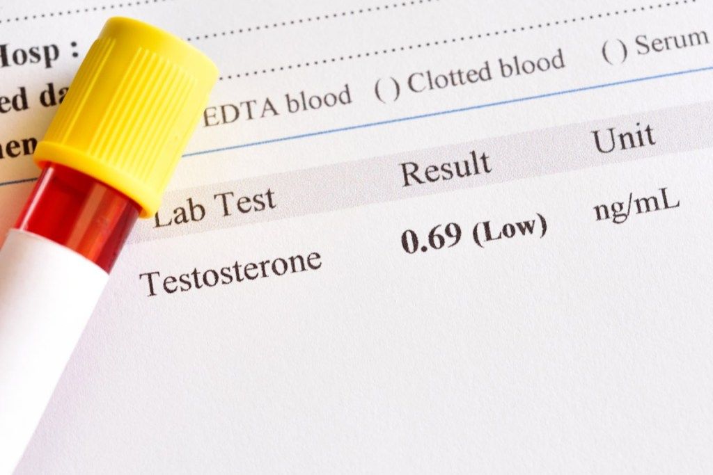 prova de resultats de laboratori de testosterona
