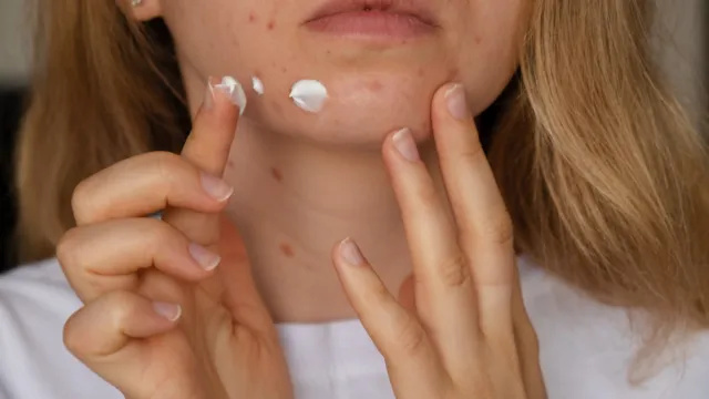 Walgreens and Target Face Cream má chemickú súvislosť s rakovinou, tvrdí výskum