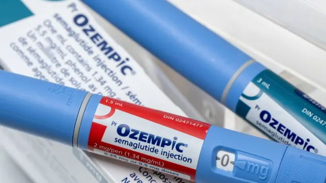 Ozempic-potilaat paljastavat merkittäviä sivuvaikutuksia, kun lopetat sen käytön